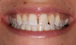 A Before-Diane-Rushford